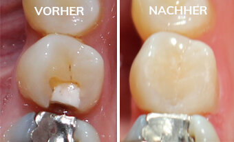 L_VORHER_NACHHER L_VORHER_NACHHER